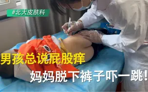 下载视频: 男孩总是说屁股痒，妈妈脱下裤子吓一跳！#白癜风# #白斑#