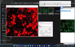 Download Video: Image J识别细胞去除干扰，统计荧光强度
