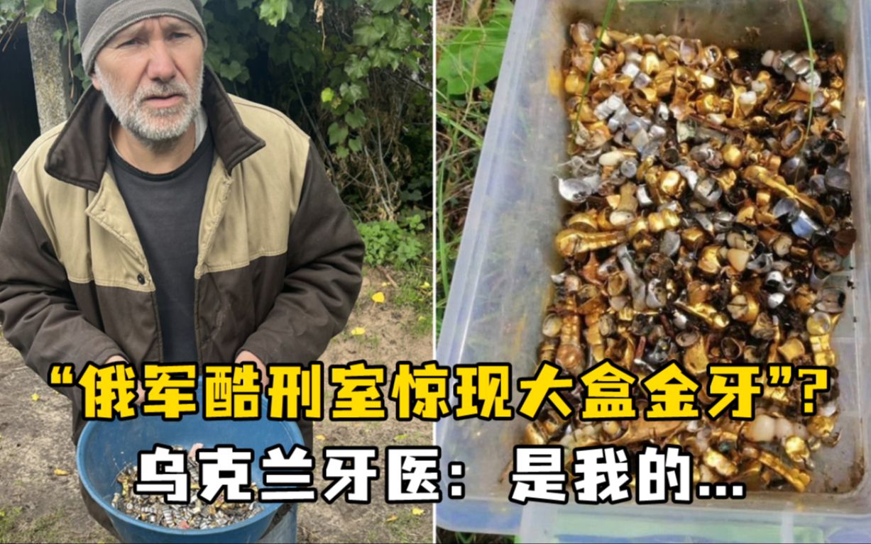 西媒炒作“俄军酷刑室惊现大盒金牙”,乌克兰牙医:嗯?哔哩哔哩bilibili