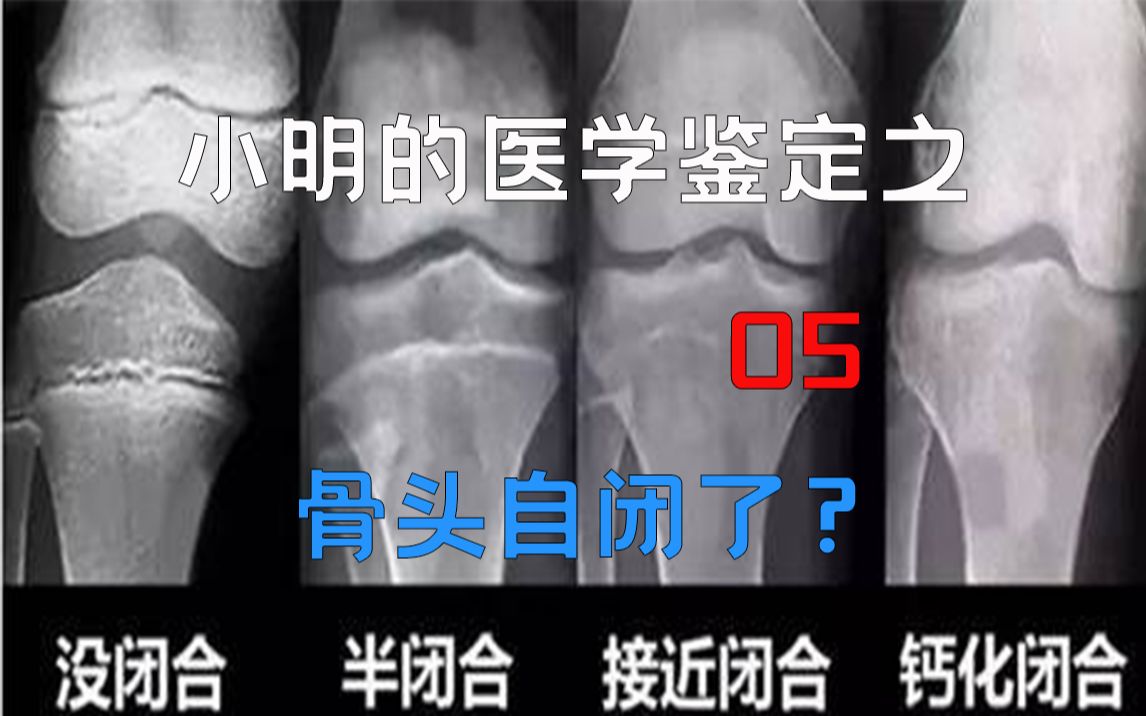 [图]《医学鉴定》网络热门医学视频鉴定05