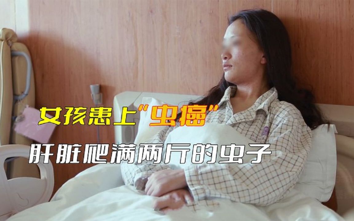 女孩患上"虫癌",医生开刀一看,肝脏爬满重达两斤虫子