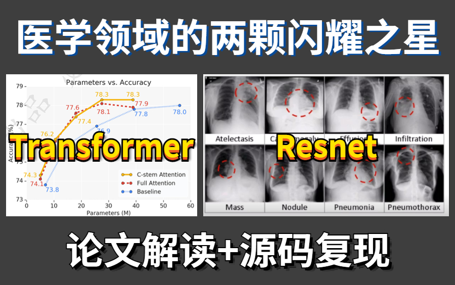 医学领域的两颗闪耀之星:Transformer+Resnet!医学分割应用与数据集分类实战!论文解读+源码复现,比刷剧还爽!哔哩哔哩bilibili