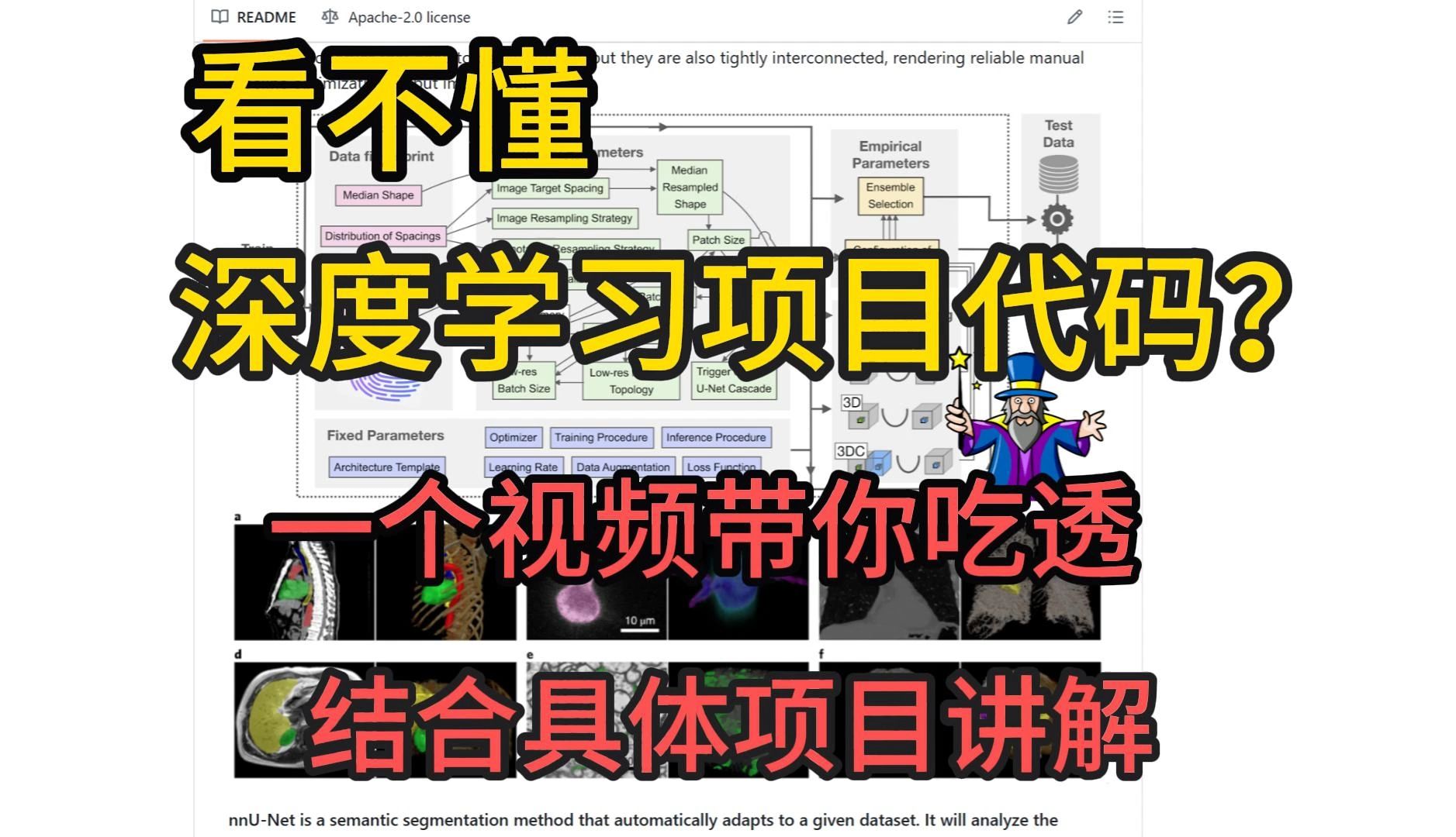 理解深度学习项目代码,具体项目复现通用方法,以nnUNet为例详细讲解哔哩哔哩bilibili