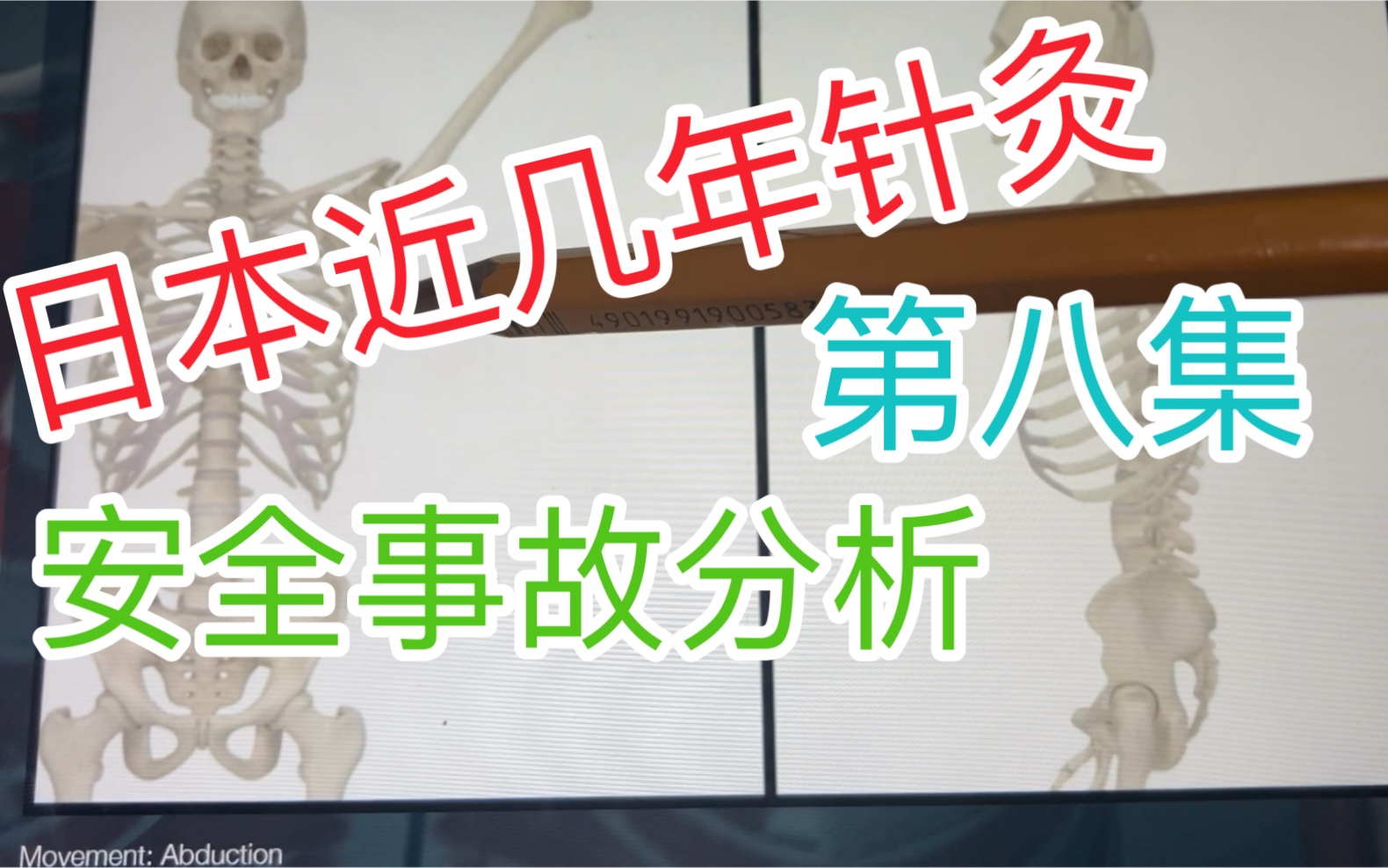 [图]近几年日本针灸事故分析，大腰肌 肾 血尿 中医 肩胛下肌 气胸 医疗事故 下垂肾 游走肾 第八集