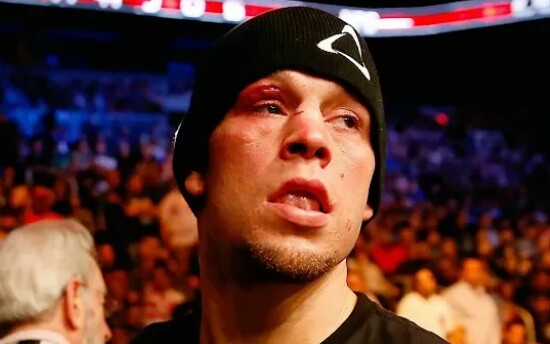 嚣张跋扈 小麻子 nate diaz highlights (hd) 2018 高光瞬间