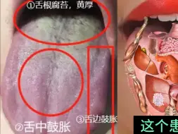 Tải video: 男人行不行，一看舌根干不干净，二看舌头鼓不鼓