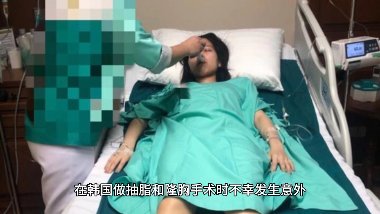 中國女子在韓做抽脂手術後死亡