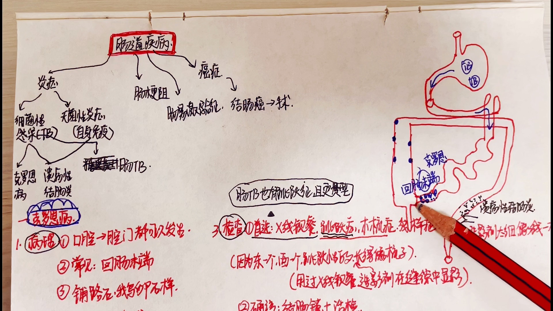 护理考研内科消化系统6克罗恩病&溃疡性结肠炎&肠易激综合征&肠结核哔哩哔哩bilibili