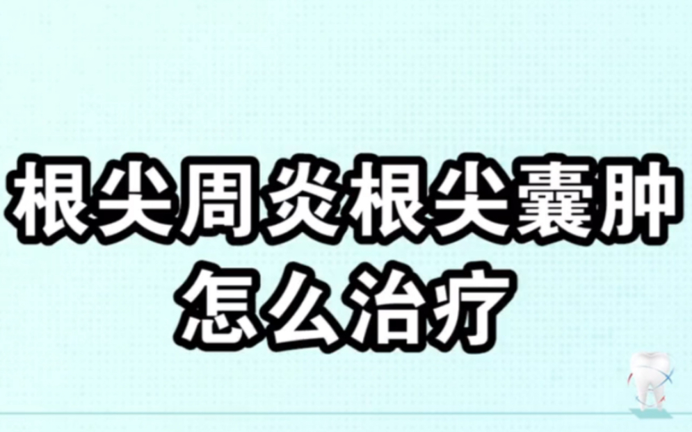 根尖周炎,长了根尖囊肿怎么办?一起来看看!哔哩哔哩bilibili