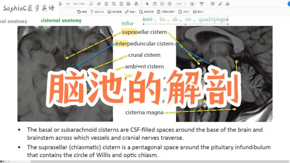 脑池的解剖.医学术语:suprasellar cistern鞍上池……以前不知医学英语重要,错过的知识只能用更多的时间和精力来获取.哔哩哔哩bilibili