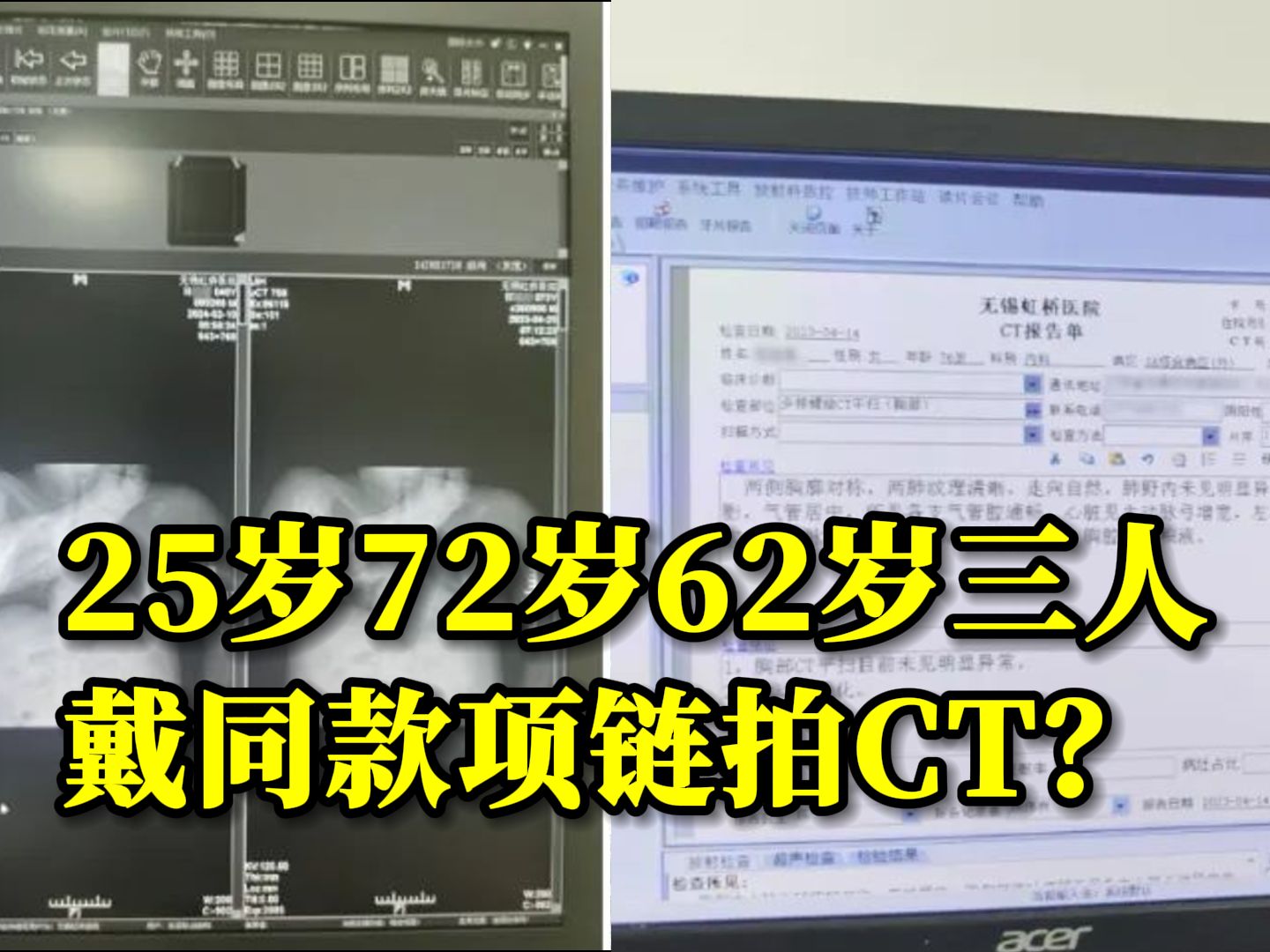 医院涉嫌骗保!25岁72岁62岁三人CT片几乎一样?无锡医保局对其行政立案哔哩哔哩bilibili