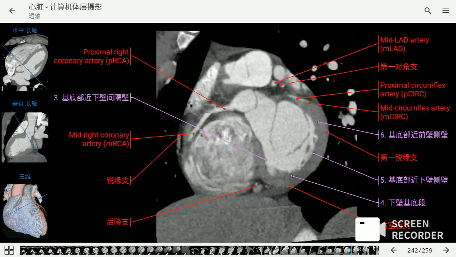 [图]影像解剖图谱神器 医学影像学必备 e-anatomy中文最新版 心脏扫描仪