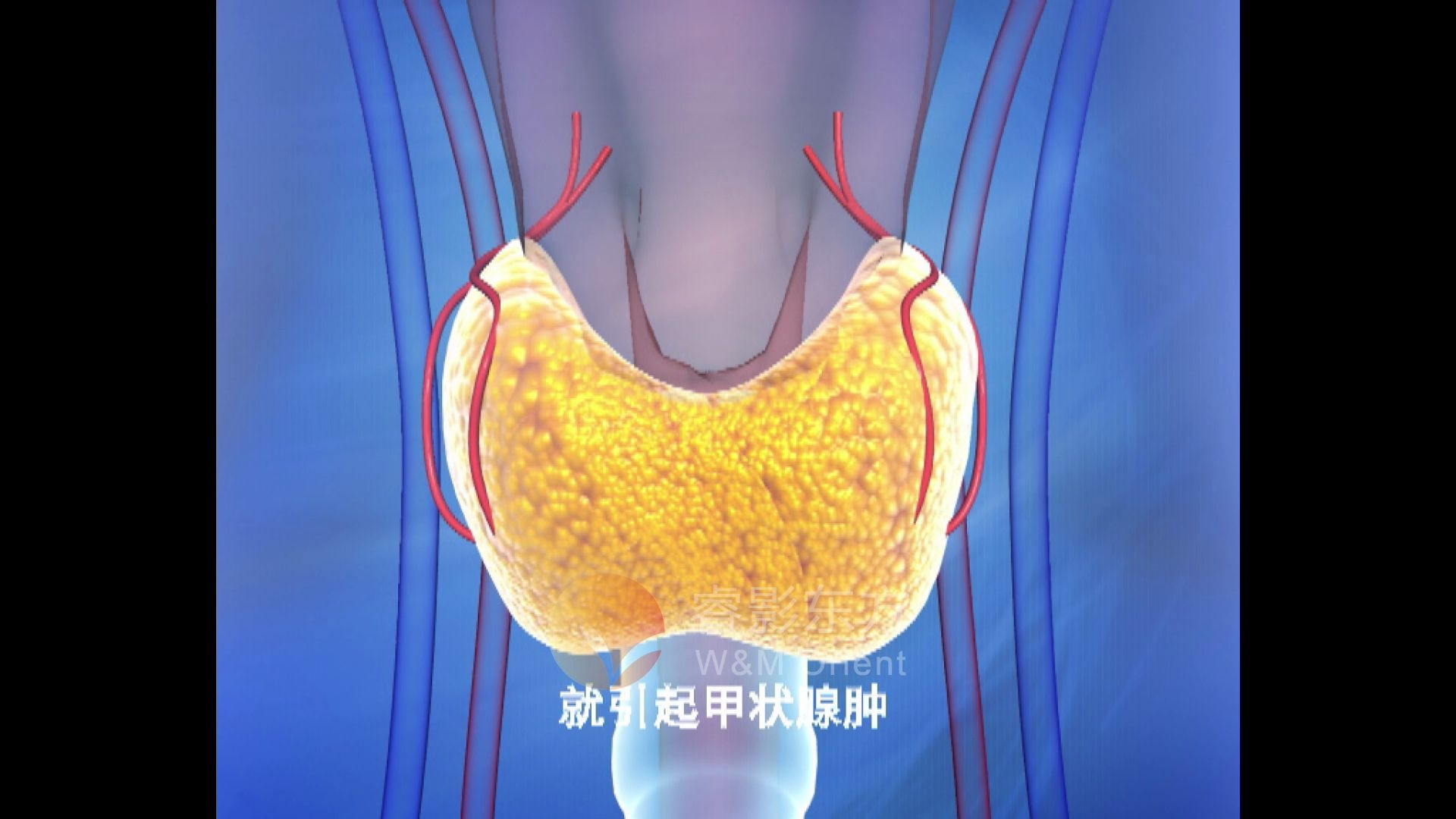 原创科普医学动画连载029—甲状腺科普第三集哔哩哔哩bilibili