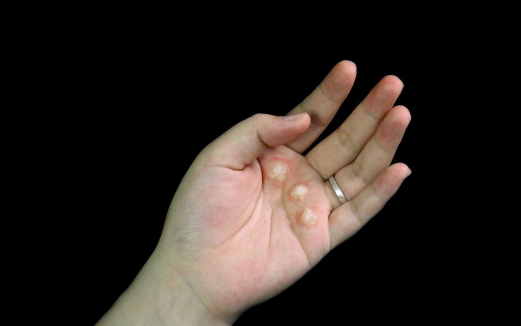 电影中演员手掌起泡原来是这样化的,卸妆看着好爽