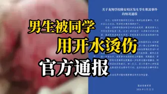 Download Video: 广西龙翔学校13岁男生遭同学8人开水烫伤霸凌，官方通报：2人刑拘 6人行拘