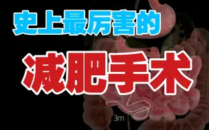 Download Video: 堪称史上最强减肥手术，暴瘦60公斤！【缪医生】