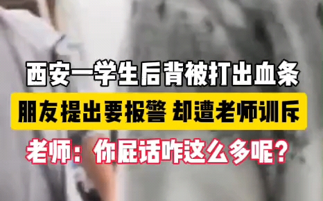 “马上高考了,你不想让我好过,这后面你也别想好过” 学生背部被打得满是伤痕要报警,老师呵斥:屁话咋哔哩哔哩bilibili