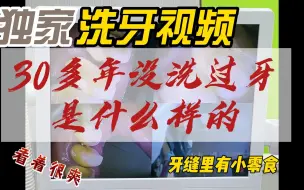 Download Video: 【商大夫】洗牙·这噼里啪啦往下掉的牙结石啊（高能在后面）