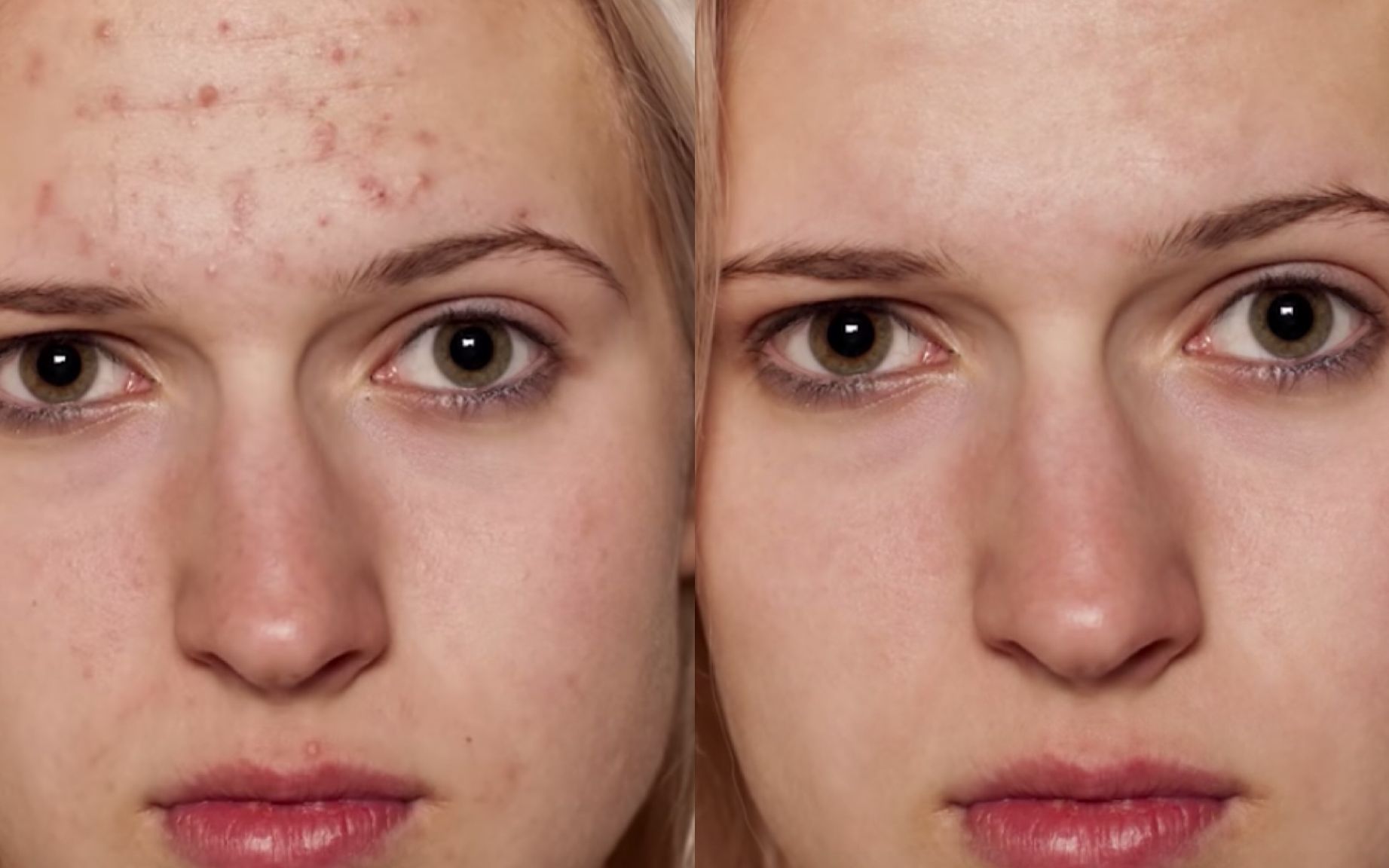 photoshop查找和删除瑕疵