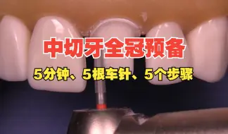 中切牙预备流程——5根车针5个步骤5分钟