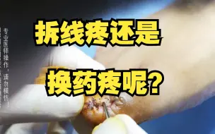 Video herunterladen: 拆线疼还是换药疼呢？