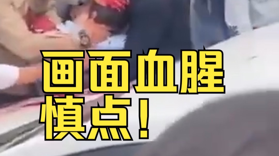哥伦比亚总统候选人遭枪击头部血流不止