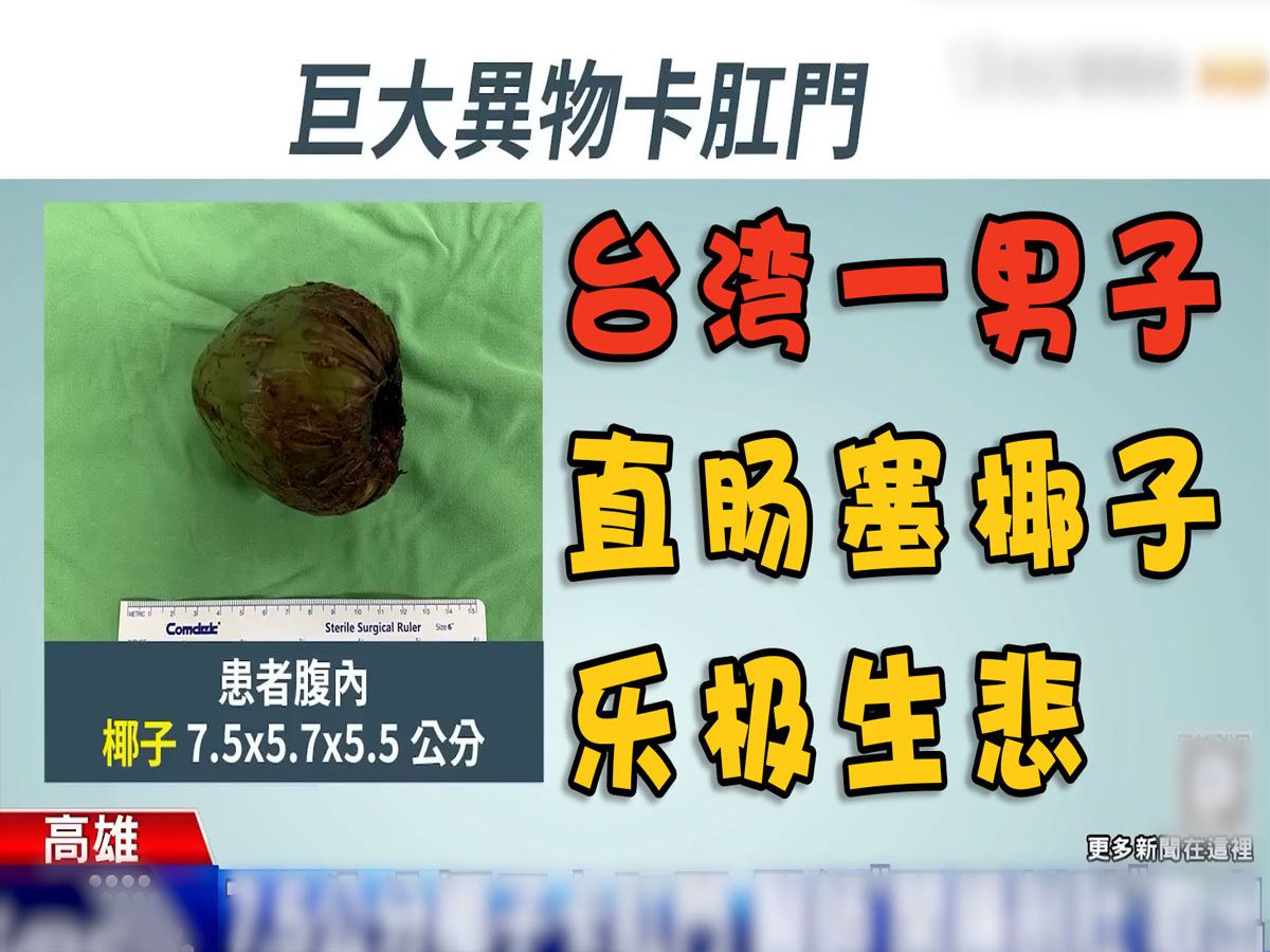 [图]台湾男子直肠塞椰子，导致腹痛不止，无奈求助医生只能剖腹产取出