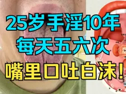 Download Video: 20岁手淫10年，一天五六次，嘴里都口吐白沫了！！