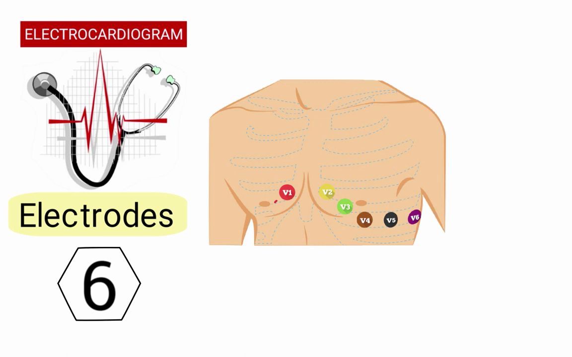 【简单解释】什么是心电图? (EKG/ECG)哔哩哔哩bilibili