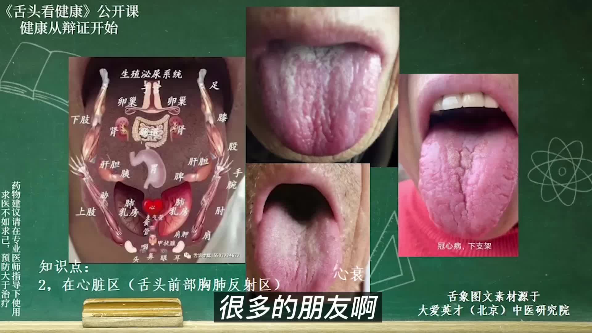 [图]舌象分析：心慌心悸，舌前心肺反射区有裂纹的舌象讲解