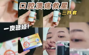 Télécharger la video: 亲测巨有用❗️3个治口腔溃疡的好东西