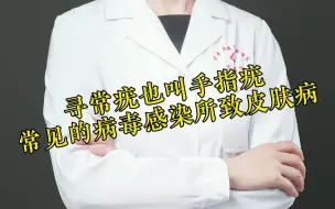 Descargar video: 你对“寻常疣”知多少？一个视频带你快速了解