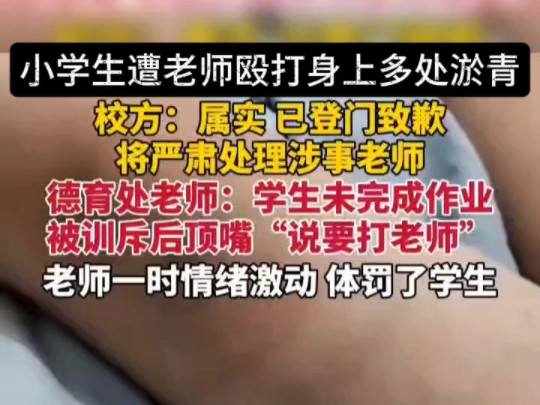 10月14日,湖北恩施(报道).校方回应“湖北恩施一小学生遭老师殴打致身上多处淤青”:属实,已登门致歉,并将严肃处理涉事老师.哔哩哔哩bilibili