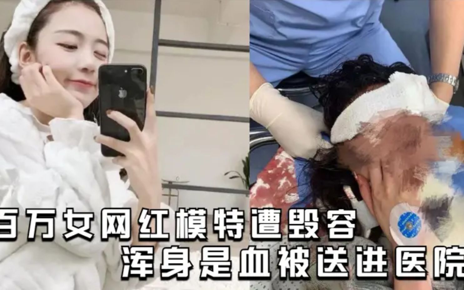 [图]110万粉丝女网红模特遭毁容，浑身是血被送进医院，疑似被人打！