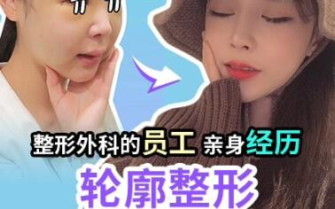 韩国ts整形外科医院轮廓手术后真实恢复过程记录 哔哩哔哩 つロ干杯 Bilibili 韩国ts整形外科医院轮廓手术后真实恢复过程记录 哔哩哔哩 つロ干杯 Bilibili